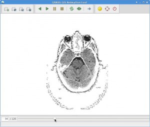 Animation of brain scan slices